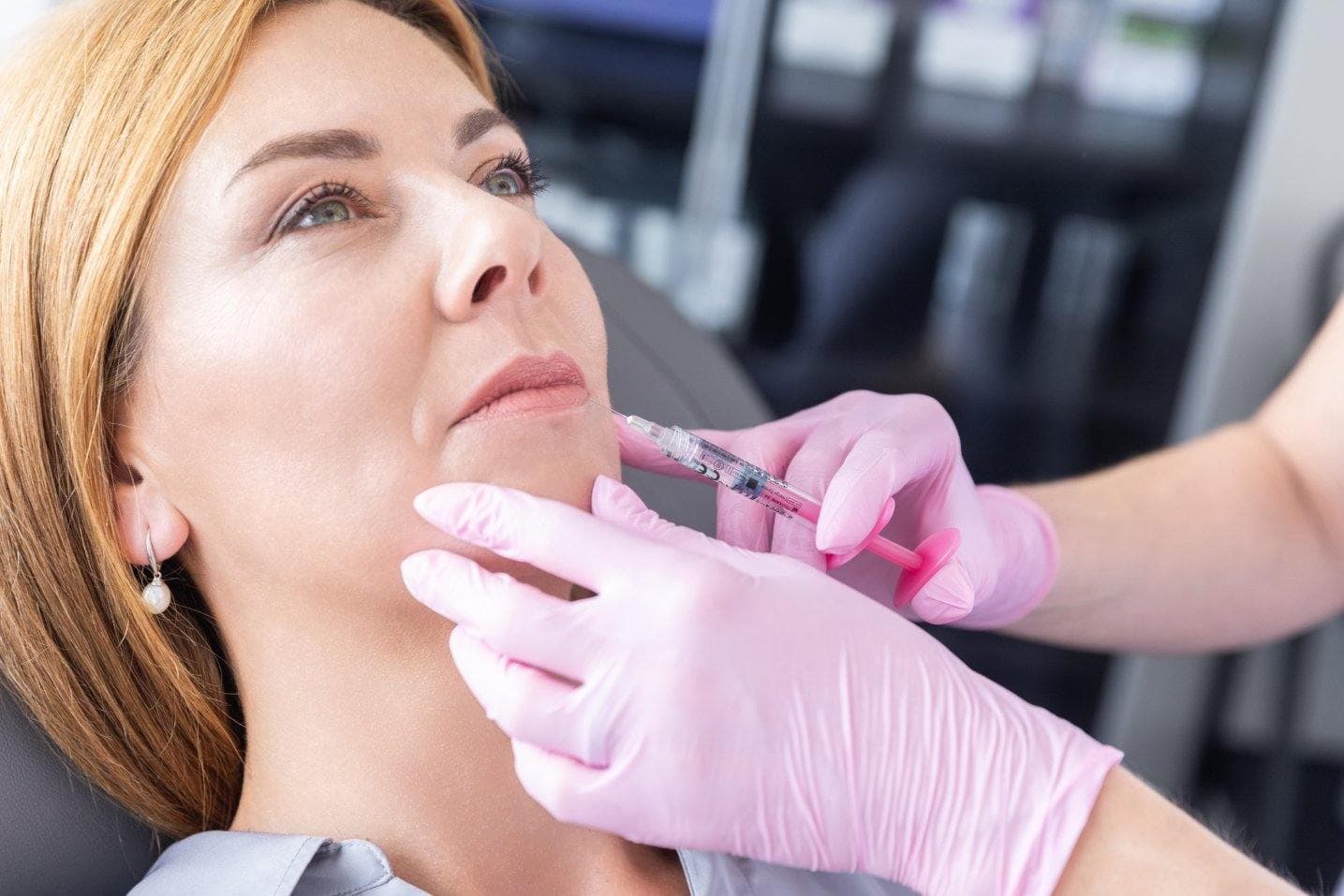 Šetrná aplikace výplně do rtů